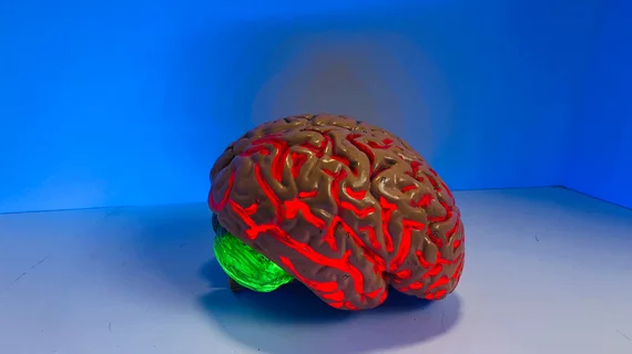 brain.jpg