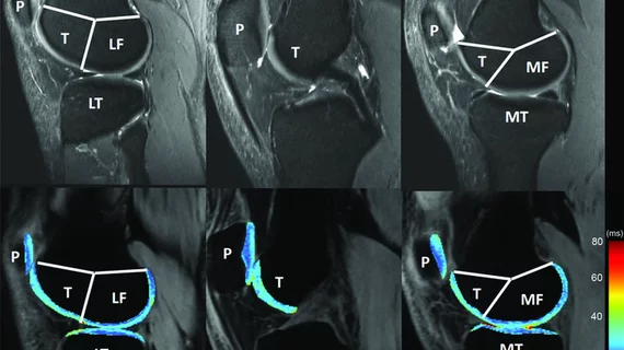 knee_mri.png
