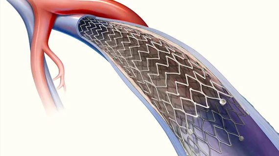 The Bard Venovo venous stent