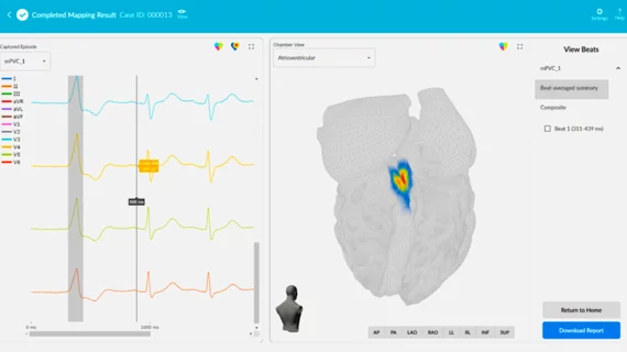 The Vektor Medical vMap system takes standard 12-lead ECGs and converts them into detailed electro anatomical maps for us in catheter ablation procedures.