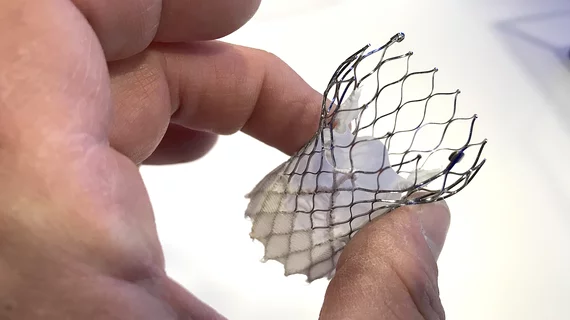 In a late-breaking long-term analysis presented at ACC 2022, the Medtronic CoreValve TAVR valve outperformed the surgical aortic valve replacement (SAVR) in terms of durability. 