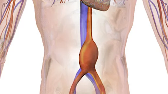 Abdominal aortic aneurysm (AAA)