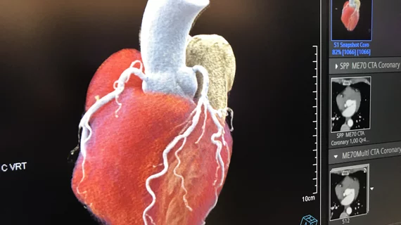 Siemens Healthineers showed examples at ACC 2022 of cardiac computed tomography (CT) from its new Naeotom Alpha photon-counting CT scanner cleared by the FDA in 2021.