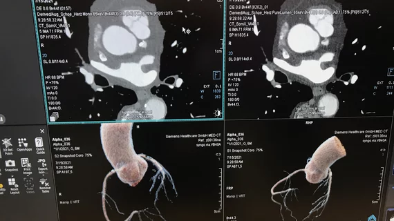 The American Society fo Nuclear Cardiology (ASNC) did not support the 2021 Chest Pain Guidelines because of the high support for cardiac CT and FFR-CT.