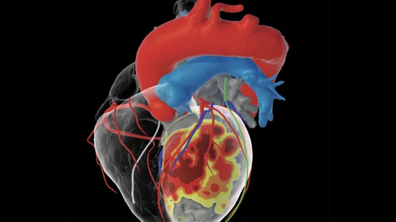 inHEART Medical, an international healthcare company with offices in France and the United States, has received clearance from the U.S. Food and Drug Administration (FDA) for its new 3D visualization software designed to improve the management of ventricular tachycardia (VT) ablation and other cardiac ablation procedures.