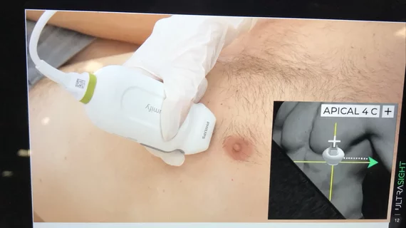 Novice medical professionals perform diagnostic quality echocardiograms with AI guidance 