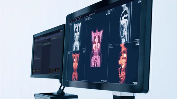 A radiologists reading station, image from Sectra