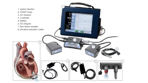 Medtronic is once again recalling its HeartWare Ventricular Assist Device (HVAD) pump implant kit, a part of the company’s HeartWare HVAD system. This is a Class I recall, which means using the device can lead to serious injury or death. The new recall includes more than 1,600 devices distributed from October 2006 to June 2021. 