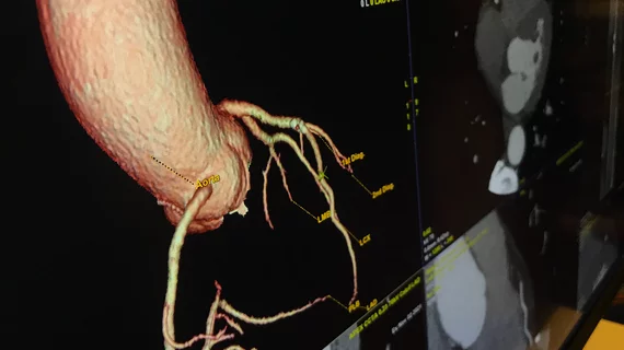 Example of a patient's coronary tree extracted from a cardiac CT scan. CT allows very detailed anatomical imaging and now physiological and plaque information that can be useful in pre-planning interventional procedures. Imaging from the GE Revolution Apex system at SCCT 2022.