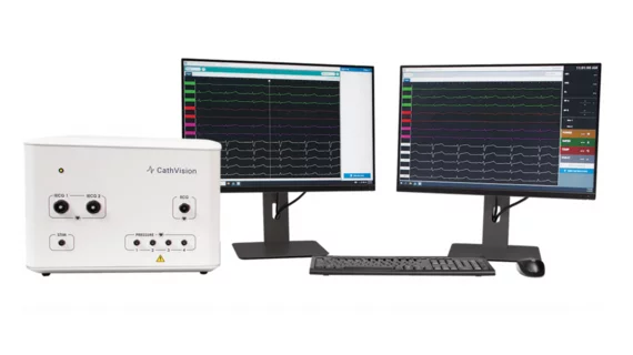CathVision’s ECGenius EP Recording System, a new solution designed to capture high-fidelity, low-noise electrocardiogram (ECG) recordings for the diagnosis and treatment of arrhythmias such as atrial fibrillation (AFib). 