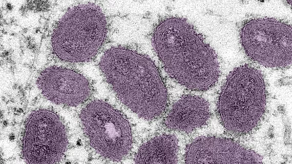 monkey_pox_nih_image.png