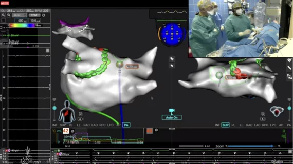 Affera Inc Medtronic $925 million catheter ablation atrial fibrillation (AFib)