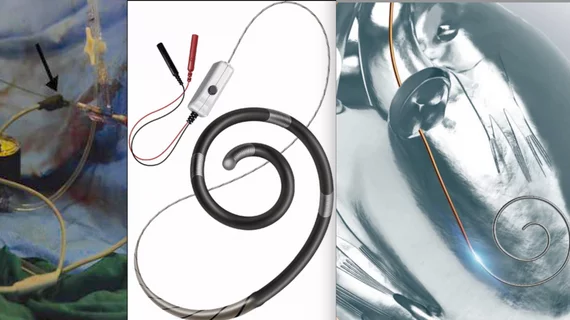 Three systems for left ventricular pacing during TAVR, modified TAVR valve delivery wire, the Opsens Savvy wire, and the Teleflex Wattson wire. 