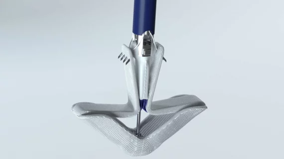 he U.S. Food and Drug Administration (FDA) granted market clearance ion September 2022 for the Edwards Lifesciences Corp. Pascal Precision transcatheter valve repair system for transcatheter edge-to-edge repair (TEER). It is indicated for the treatment of patients with degenerative mitral regurgitation (DMR). 