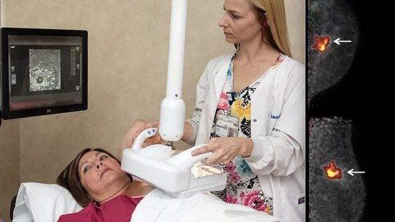 Supplemental breast imaging modalities of automated breast ultrasound (ABUS) and molecular imaging.