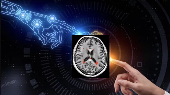 Charles E. Kahn, Jr., MD, MS, editor of the the RSNA journal Radiology: Artificial Intelligence, and professor and vice chair of radiology at the University of Pennsylvania Perelman School of Medicine. He discusses the need to validate artificial intelligence (AI) algorithms with your own patient population to determine if it is accurate for a specific institutions patients. He also explains how bias can be inadvertently added into a algorithm, and how the AI may take learning shortcuts. #AI