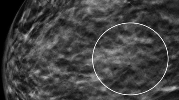 DBT plus SM for extremely dense breasts