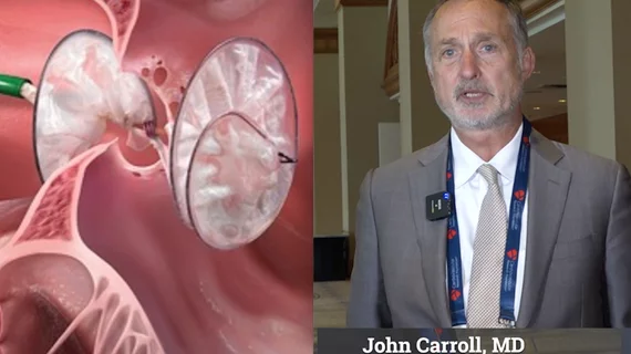 john_carroll_on_pfo_closure.jpg
