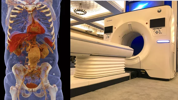 Advances in computed tomography scanner (CT) technology include photon-counting (Siemens image left) and faster, higher slice CT systems with integrated AI. Right image is GE Healthcare's Revolution on display at SCCT 2022. Trends in CT imaging by Signify Research.