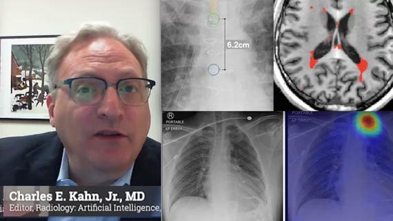 Charles E. Kahn, Jr., MD, MS, Editor of the the RSNA journal Radiology: Artificial Intelligence, and professor and vice chair of radiology at the University of Pennsylvania Perelman School of Medicine, discusses trends in radiology medical imaging AI. He has been heavily involved in radiology informatics and has seen up close the evolution of radiology toward deeper integration with AI. #RSNA22