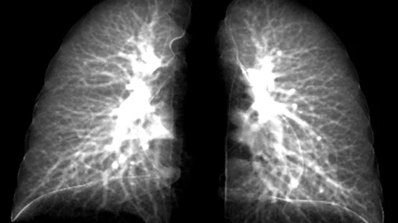 post-covid-lung-story-photo.jpg