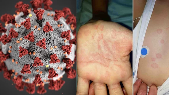 Nemours Children's Hospital pediatric cardiologists explain lessons learned about cardiac involvement and long-term issues from multisystem inflammatory syndrome in children (MIS-C), a rare but serious disease caused by exposure to the COVID-19 virus. #MIS-C #COVID #coronavirus #SARSCoV2