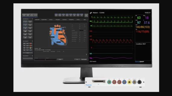Fysicon’s QMAPP Hemodynamic Monitoring Device