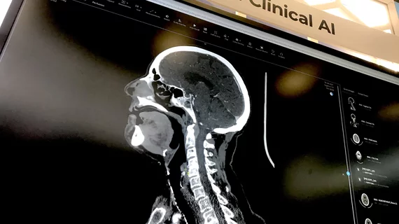 Brain imaging artificial intelligence is a primary area of concentration for AI because oif the critical nature of fast detection and treatment for patients. This is an example of the AI applications displayed by third-party advanced visualization vendor TeraRecon at RSNA 2022.