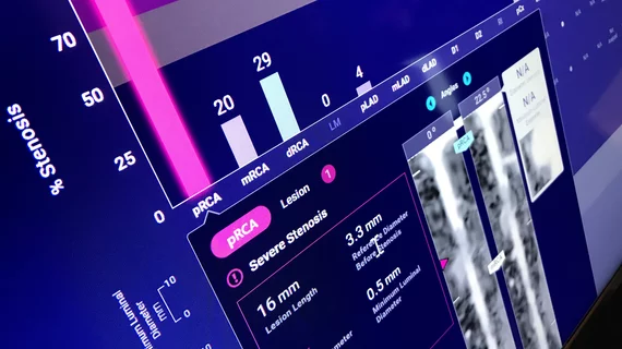 An example of an FDA cleared radiology AI algorithm to automatically take a cardiac CT scan and identify, contour and quantify soft plaque in the coronary arteries. The Cleerly software then generates an automated report with images, measurements and a risk assessment for the patient. This type of quantification is too time consuming and complex for human readers to bother with, but AI assisted reports like this may become a new normal over the next decade. Example from Cleerly Imaging at SCCT 2022.
