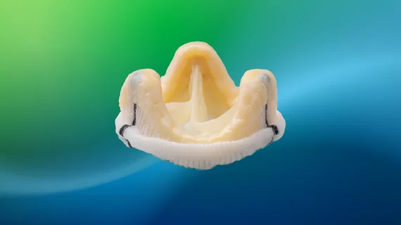 Abbott Epic Max heart valve for aortic valve disease