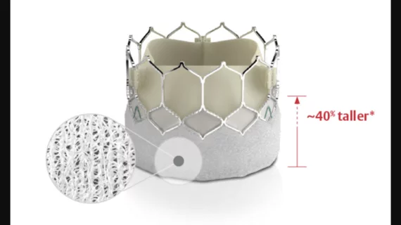 The SAPIEN 3 Ultra (S3U) transcatheter heart valve from Edwards Lifesciences. A study presented at ESC Congress 2024 in London, confirmed that TAVR was associated with significantly better outcomes than surgery when treating female patients. 