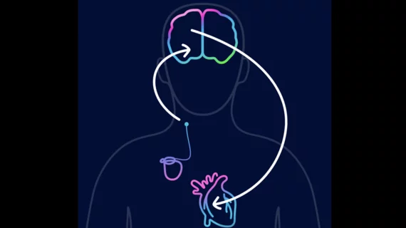 CVRx Barostim illustration