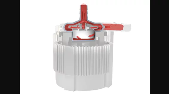 Abbott centrimag life support system