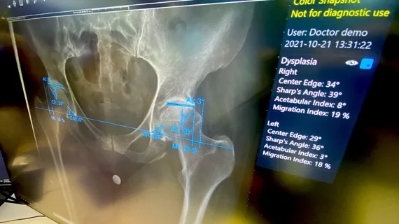 AI artificial intelligence automated measurements for hip dysplasia Sectra HIMSS23 DF