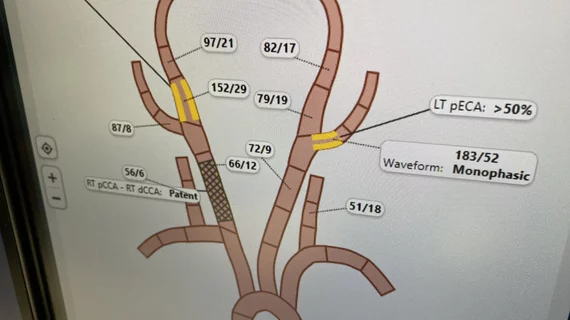 An interactive diagram for the carotids and arteries of the brain for interventional reporting shown by Fujifilm at HIMSS 2023. Photo by Dave Fornell