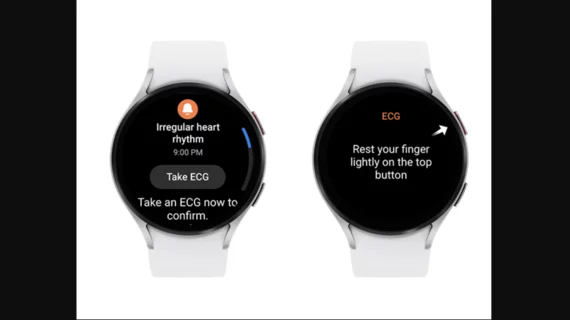 Samsung galaxy smartwatch showing atrial fibrillation (AFib) alerts