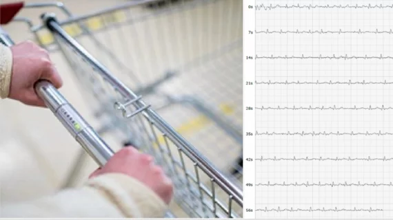 Shopping Cart ECG electrocardiogram AFib atrial fibrillation