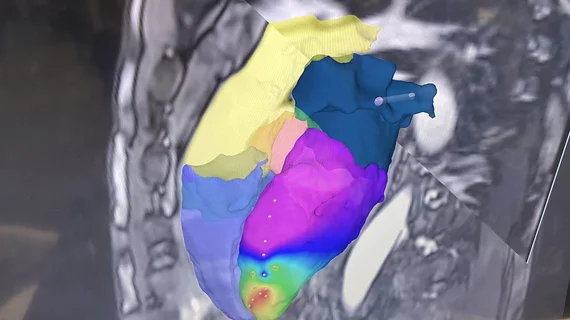 MRI-guided EP lab ablation procedure using mapping and MRI-safe catheters from Imricor, displayed at HRS 2023. Photo by Dave Fornell