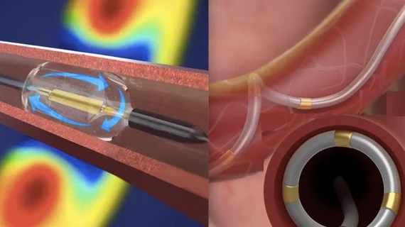 The ReCor (left) and Medtronic Symplicity Spyral renal denervation systems.