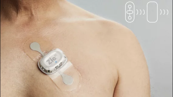 Zio AT mobile cardiac telemetry device