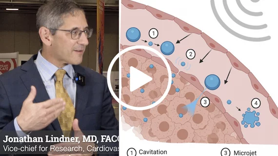 Video of Jon Lindner explaining the use of ultrasound and bubble contrast for therapy.