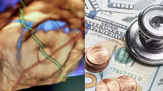 The Society for Cardiovascular Angiography and Interventions (SCAI), American College of Cardiology (ACC) and Heart Rhythm Society (HRS) have asked the U.S. Centers for Medicare and Medicaid Services (CMS) to clarify a key detail related to the national coverage determination (NCD) for percutaneous left atrial appendage closure (LAAC).