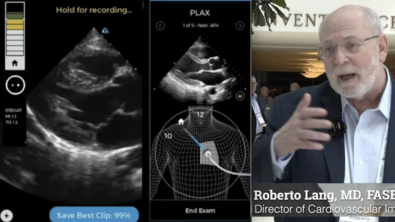 Roberto Lang, MD, explains how AI can help novice users get diagnostic quality cardiac echo exams at ASE 2023.#ASE #AI #ASE2023