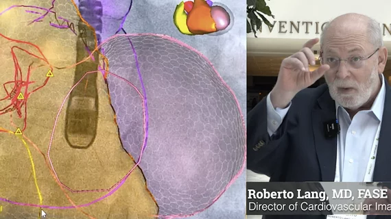 Roberto Lang, MD, explained the AI advances in echocardiography that will make it a requirement to have in the coming years at ASE 2023. #ASE #AIhealthcare #ASE2023