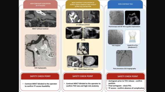 No contrast transcatheter aortic valve replacement
