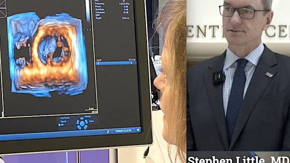 Stephen Little, MD, discusses trends in echocardiography at ASE 2023. #ASE23 #ASE2023 What is new in cardiac ultrasound.
