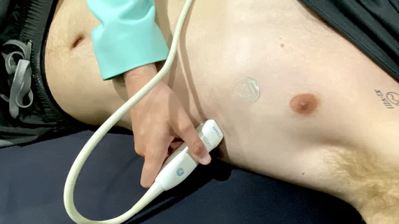 Ultrasound cardiac echo patient being scanned with transducer in US2 AI booth ASE 2023.