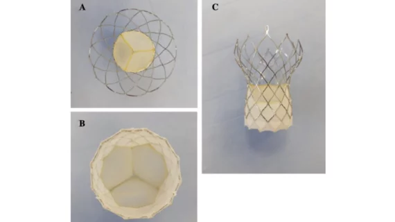 Vienna Aortic Self-Expandable Transcatheter Valve premounted on the delivery system