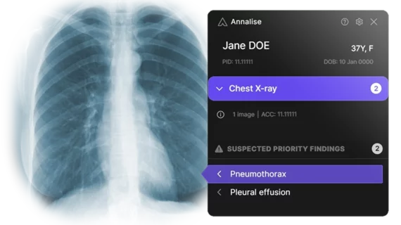 medical imaging exam annalise.ai