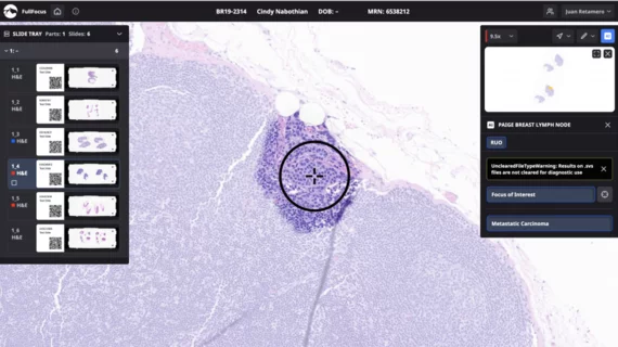 Paige Breast Lymph Node Screenshot